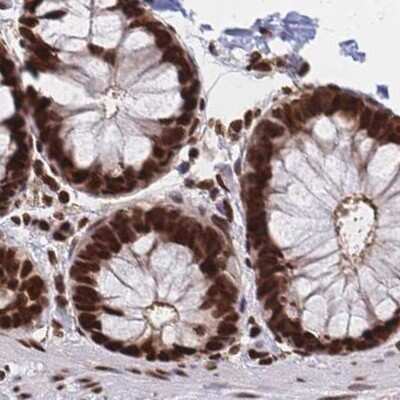 Immunohistochemistry-Paraffin: HDGF Antibody [NBP2-38701] - Staining of human colon.