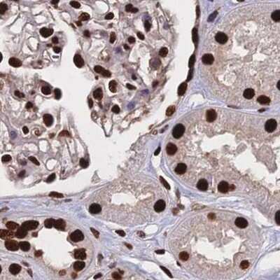 Immunohistochemistry-Paraffin: HDGF Antibody [NBP2-38701] - Staining of human kidney.