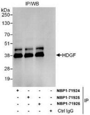 Immunoprecipitation: HDGF Antibody [NBP1-71924] - Whole cell lysate (1 mg for IP, 20% of IP loaded) from HeLa cells.    Affinity purified rabbit anti-HDGF antibody used for IP at 6 mcg/mg lysate.  HDGF was also immunoprecipitated by rabbit anti-HDGF antibodies NBP1-71925 and NBP1-71926, which recognize downstream epitopes.