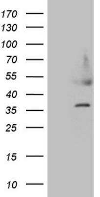 Western Blot: HDGF Antibody (OTI8C7) [NBP2-45953] - HEK293T cells were transfected with the pCMV6-ENTRY control (Left lane) or pCMV6-ENTRY HDGF (Right lane) cDNA for 48 hrs and lysed. Equivalent amounts of cell lysates (5 ug per lane) were separated by SDS-PAGE and immunoblotted with anti-HDGF.