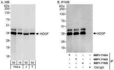 Western Blot: HDGF Antibody [NBP1-71925] - Whole cell lysate from HeLa (15 and 50 mcg for WB; 1 mg for IP, 20% of IP loaded), Jurkat (J; 50 mcg) and 293T (T; 50 mcg) cells.   Affinity purified rabbit anti-HDGF antibody  used for WB at 0.04 mcg/ml (A) and 1 mcg/ml (B) and used for IP at 6 mcg/mg lysate.  HDGF was also immunoprecipitated by rabbit anti-HDGF antibodies NBP1-71924 and NBP1-71926, which recognize other epitopes.