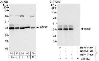 Western Blot: HDGF Antibody [NBP1-71926] - Whole cell lysate from HeLa (15 and 50 mcg for WB; 1 mg for IP, 20% of IP loaded), Jurkat (J; 50 mcg), 293T (T; 50 mcg), and mouse NIH3T3 (M; 50 mcg) cells.   Antibodies: Affinity purified rabbit anti-HDGF antibody  used for WB at 0.04 mcg/ml (A) and 1 mcg/ml (B) and used for IP at 6 mcg/mg lysate.  HDGF was also immunoprecipitated by rabbit anti-HDGF antibodies NBP1-71924 and NBP1-71925, which recognize upstream epitopes.