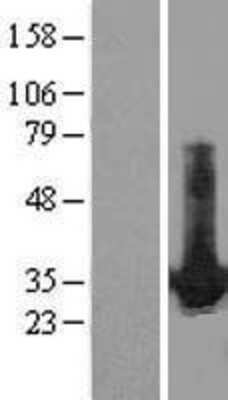 Western Blot HDGF Overexpression Lysate