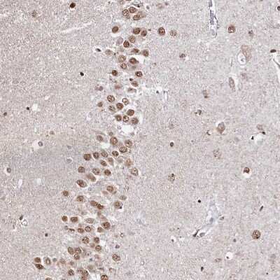 Immunohistochemistry-Paraffin HDGFRP3 Antibody - BSA Free