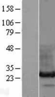 Western Blot: HDGFRP3 Overexpression Lysate (Adult Normal) [NBL1-11490] Left-Empty vector transfected control cell lysate (HEK293 cell lysate); Right -Over-expression Lysate for HDGFRP3.