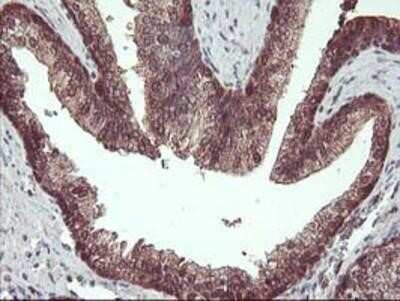 Immunohistochemistry: HDHD1A Antibody (OTI7A2) - Azide and BSA Free [NBP2-71368] - Staining of paraffin-embedded Human prostate tissue using anti-HDHD1A mouse monoclonal antibody.