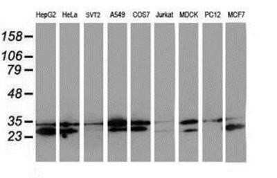 Western Blot: HDHD1A Antibody (OTI7A2) - Azide and BSA Free [NBP2-71368] - Analysis of extracts (35ug) from 9 different cell lines by using anti-HDHD1A monoclonal antibody.