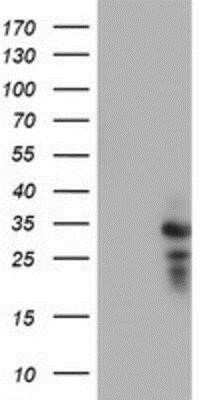 Western Blot: HDHD1A Antibody (OTI7A2) - Azide and BSA Free [NBP2-71368] - HEK293T cells were transfected with the pCMV6-ENTRY control (Left lane) or pCMV6-ENTRY HDHD1A (Right lane) cDNA for 48 hrs and lysed. Equivalent amounts of cell lysates (5 ug per lane) were separated by SDS-PAGE and immunoblotted with anti-HDHD1A.