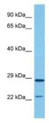 Western Blot: HDHD1A Antibody [NBP3-10058] - Western blot analysis of HDHD1A in Human Hela Whole Cell lysates. Antibody dilution at 1ug/ml