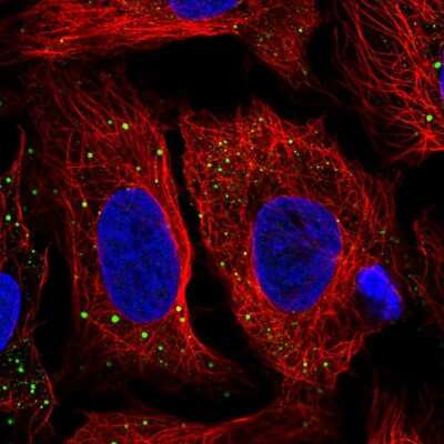 Immunocytochemistry/Immunofluorescence: HDHD2 Antibody [NBP2-31799] - Immunofluorescent staining of human cell line U-2 OS shows localization to vesicles.
