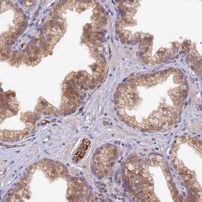 Immunohistochemistry HDHD2 Antibody - BSA Free