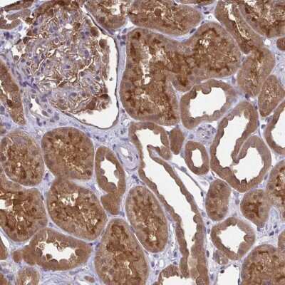 Immunohistochemistry-Paraffin: HDHD2 Antibody [NBP2-31799] - Staining of human kidney shows strong cytoplasmic and membranous positivity in cells in tubules.