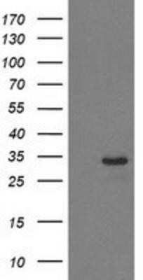 Western Blot: HDHD2 Antibody (OTI4G3) - Azide and BSA Free [NBP2-72259] - HEK293T cells were transfected with the pCMV6-ENTRY control (Left lane) or pCMV6-ENTRY HDHD2 (Right lane) cDNA for 48 hrs and lysed. Equivalent amounts of cell lysates (5 ug per lane) were separated by SDS-PAGE and immunoblotted with anti-HDHD2.