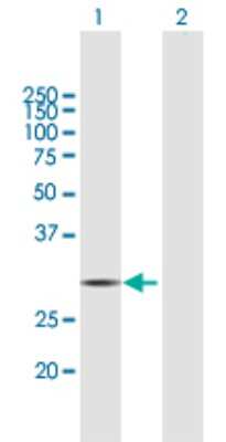 Western Blot: HDHD2 Antibody [H00084064-B01P] - Analysis of HDHD2 expression in transfected 293T cell line by HDHD2 polyclonal antibody.  Lane 1: HDHD2 transfected lysate(28.49 KDa). Lane 2: Non-transfected lysate.