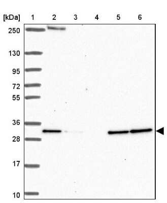 Western Blot HDHD2 Antibody - BSA Free