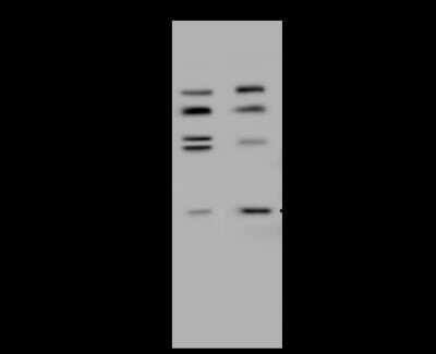 Western Blot: HDHD2 Antibody [NBP2-99209] - Anti-HDHD2 rabbit polyclonal antibody at 1:500 dilution. Lane A: HeLa Whole Cell Lysate. Lane B: Jurkat Whole Cell Lysate. Lysates/proteins at 30 ug per lane. Secondary Goat Anti-Rabbit IgG (H+L)/HRP at 1/10000 dilution. Developed using the ECL technique. Performed under reducing conditions. Predicted band size: 29 kDa. Observed band size: 29 kDa