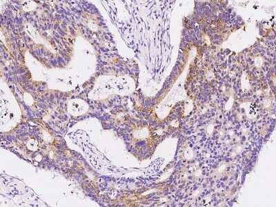 Immunohistochemistry-Paraffin: HDHD3 Antibody [NBP2-99145] - Immunochemical staining of human HDHD3 in human adrenal gland with rabbit polyclonal antibody at 1:300 dilution, formalin-fixed paraffin embedded sections.