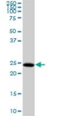 Western Blot: HDHD3 Antibody [H00081932-B01P] - Analysis of HDHD3 expression in human liver.
