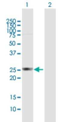 Western Blot: HDHD3 Antibody [H00081932-B01P] - Analysis of HDHD3 expression in transfected 293T cell line by HDHD3 polyclonal antibody.  Lane 1: HDHD3 transfected lysate(27.61 KDa). Lane 2: Non-transfected lysate.