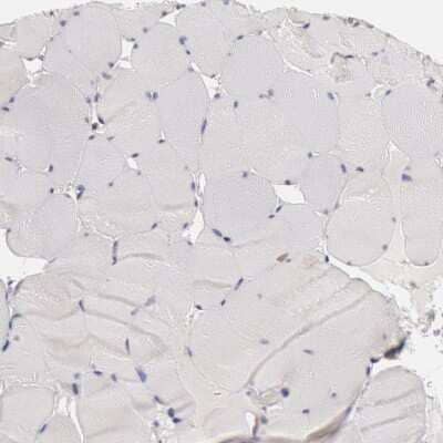 Immunohistochemistry-Paraffin: HDJ2 Antibody [NBP1-88019] - Staining of human skeletal muscle shows no positivity in myocytes as expected.