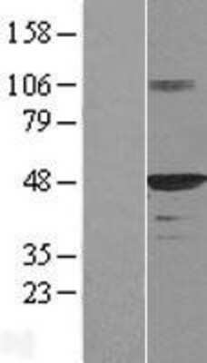 Western Blot: HDJ2 Overexpression Lysate (Adult Normal) [NBL1-09929] Left-Empty vector transfected control cell lysate (HEK293 cell lysate); Right -Over-expression Lysate for HDJ2.