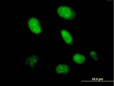 Immunocytochemistry/ Immunofluorescence HDX Antibody