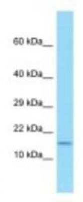 Western Blot: HE2 Antibody [NBP1-98296] - HCT15 Cell Lysate 1.0ug/ml, Gel Concentration: 10-20%