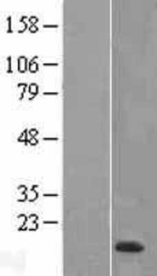 Western Blot: HE4 Overexpression Lysate (Adult Normal) [NBL1-17841] Left-Empty vector transfected control cell lysate (HEK293 cell lysate); Right -Over-expression Lysate for HE4.