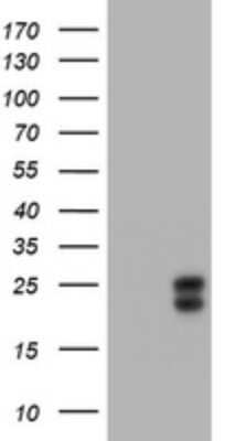 Western Blot: HE4/WFDC2 Antibody (OTI1E12) - Azide and BSA Free [NBP2-71599] - Analysis of HEK293T cells were transfected with the pCMV6-ENTRY control (Left lane) or pCMV6-ENTRY WFDC2.