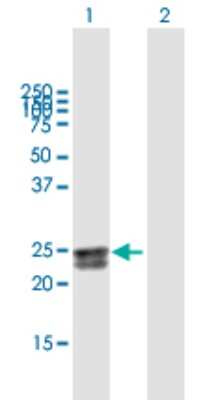 Western Blot HEATR2 Antibody - Azide and BSA Free