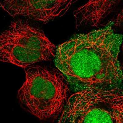 Immunocytochemistry/Immunofluorescence: HEATR3 Antibody [NBP2-56248] - Staining of human cell line HEK 293 shows localization to nucleus & cytosol.