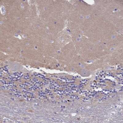 Immunohistochemistry-Paraffin: HEATR3 Antibody [NBP1-93966] - Staining of human cerebellum shows no positivity in Purkinje cells as expected.