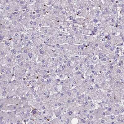 Immunohistochemistry-Paraffin: HEATR3 Antibody [NBP1-93966] - Staining of human liver shows no positivity in hepatocytes as expected.