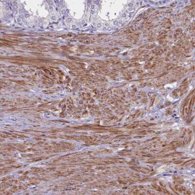 Immunohistochemistry-Paraffin: HEATR3 Antibody [NBP1-93966] - Staining of human prostate shows strong cytoplasmic positivity in smooth muscle cells.