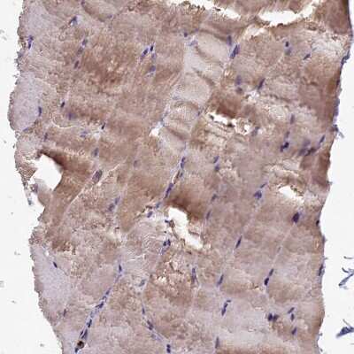 Immunohistochemistry-Paraffin: HEATR3 Antibody [NBP1-93966] - Staining of human skeletal muscle shows moderate cytoplasmic positivity in myocytes.