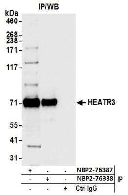 Immunoprecipitation: HEATR3 Antibody [NBP2-76387] - Samples: Whole cell lysate (1.0 mg per IP reaction; 20% of IP loaded) from HEK293T cells prepared using NETN lysis buffer. Antibodies: Affinity purified rabbit anti-HEATR3 antibody NBP2-76387 used for IP at 100 ul per reaction. HEATR3 was also immunoprecipitated by rabbit anti-HEATR3 antibody NBP2-76388. For blotting immunoprecipitated HEATR3, NBP2-76387 was used at 1:1000. Detection: Chemiluminescence with an exposure time of 1 second.