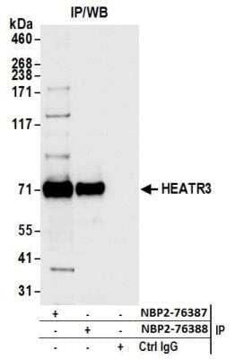 Immunoprecipitation: HEATR3 Antibody [NBP2-76388] - Samples: Whole cell lysate (1.0 mg per IP reaction; 20% of IP loaded) from HEK293T cells prepared using NETN lysis buffer. Antibodies: Affinity purified rabbit anti-HEATR3 antibody NBP2-76388 used for IP at 15 ul per reaction. HEATR3 was also immunoprecipitated by rabbit anti-HEATR3 antibody NBP2-76387. For blotting immunoprecipitated HEATR3, NBP2-76388 was used at 1:1000. Detection: Chemiluminescence with an exposure time of 1 second.