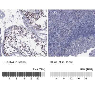 Immunocytochemistry/ Immunofluorescence HEATR4 Antibody