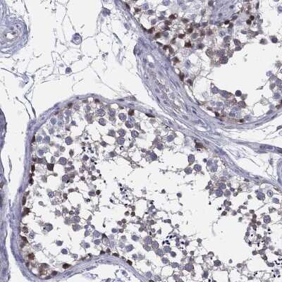 Immunohistochemistry-Paraffin HEATR4 Antibody