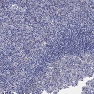 Immunohistochemistry-Paraffin HEATR4 Antibody