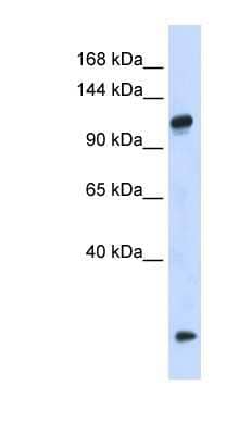 Western Blot: HEATR4 Antibody [NBP1-79609] - 293T cells lysate, concentration 0.2-1 ug/ml.