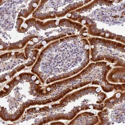 Immunohistochemistry-Paraffin: HEATR5B Antibody [NBP1-94067] - Staining of human duodenum shows strong cytoplasmic positivity in glandular cells.