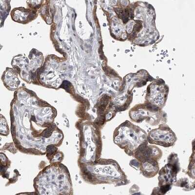 Immunohistochemistry-Paraffin HEATR6 Antibody - BSA Free