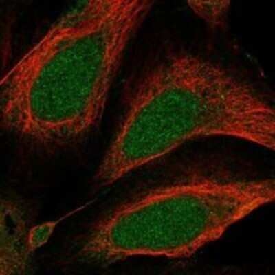 Immunocytochemistry/Immunofluorescence: HEATR7A Antibody [NBP3-17503] - Staining of human cell line U-2 OS shows localization to nucleoplasm & cytosol.