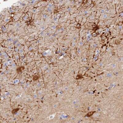Immunohistochemistry-Paraffin: HEATR7A Antibody [NBP1-93571] - Staining of human cerebral cortex shows moderate cytoplasmic positivity in neuronal cells.