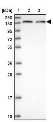 Western Blot: HEATR7A Antibody [NBP1-93571] - Lane 1: Marker  [kDa] 250, 130, 95, 72, 55, 36, 28, 17, 10.  Lane 2: Human cell line RT-4.  Lane 3: Human cell line U-251MG sp
