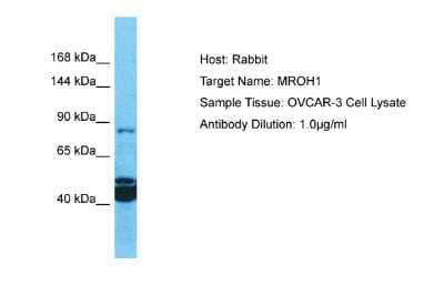 Western Blot: HEATR7A Antibody [NBP2-83037] - Host: Rabbit. Target Name: MROH1. Sample Tissue: Human OVCAR-3 Whole Cell. Antibody Dilution: 1ug/ml