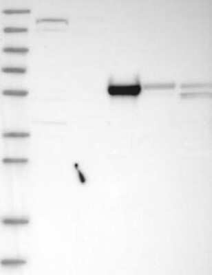 Western Blot: HEATR7A Antibody [NBP3-17503] - Lane 1: Marker [kDa] 230, 130, 95, 72, 56, 36, 28, 17, 11;   Lane 2: RT4;   Lane 3: U-251 MG;   Lane 4: Human Plasma;   Lane 5: Liver;   Lane 6: Tonsil