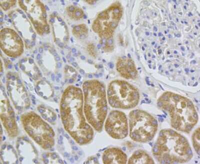 Immunohistochemistry-Paraffin: HEATR8 Antibody (A5-D4-A6) [NBP2-66884] - Analysis of paraffin-embedded human kidney tissue using anti-C1orf175 antibody. Counter stained with hematoxylin.