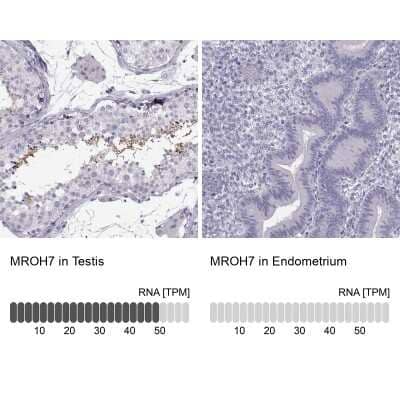 Immunohistochemistry-Paraffin: HEATR8 Antibody [NBP2-62673] - Analysis in human testis and endometrium tissues using Anti-MROH7 antibody. Corresponding MROH7 RNA-seq data are presented for the same tissues.